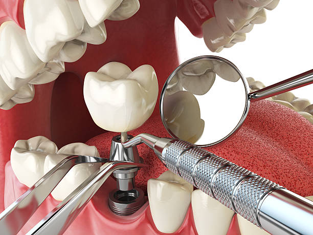 Best Emergency Tooth Extraction in Madison Heights, MI